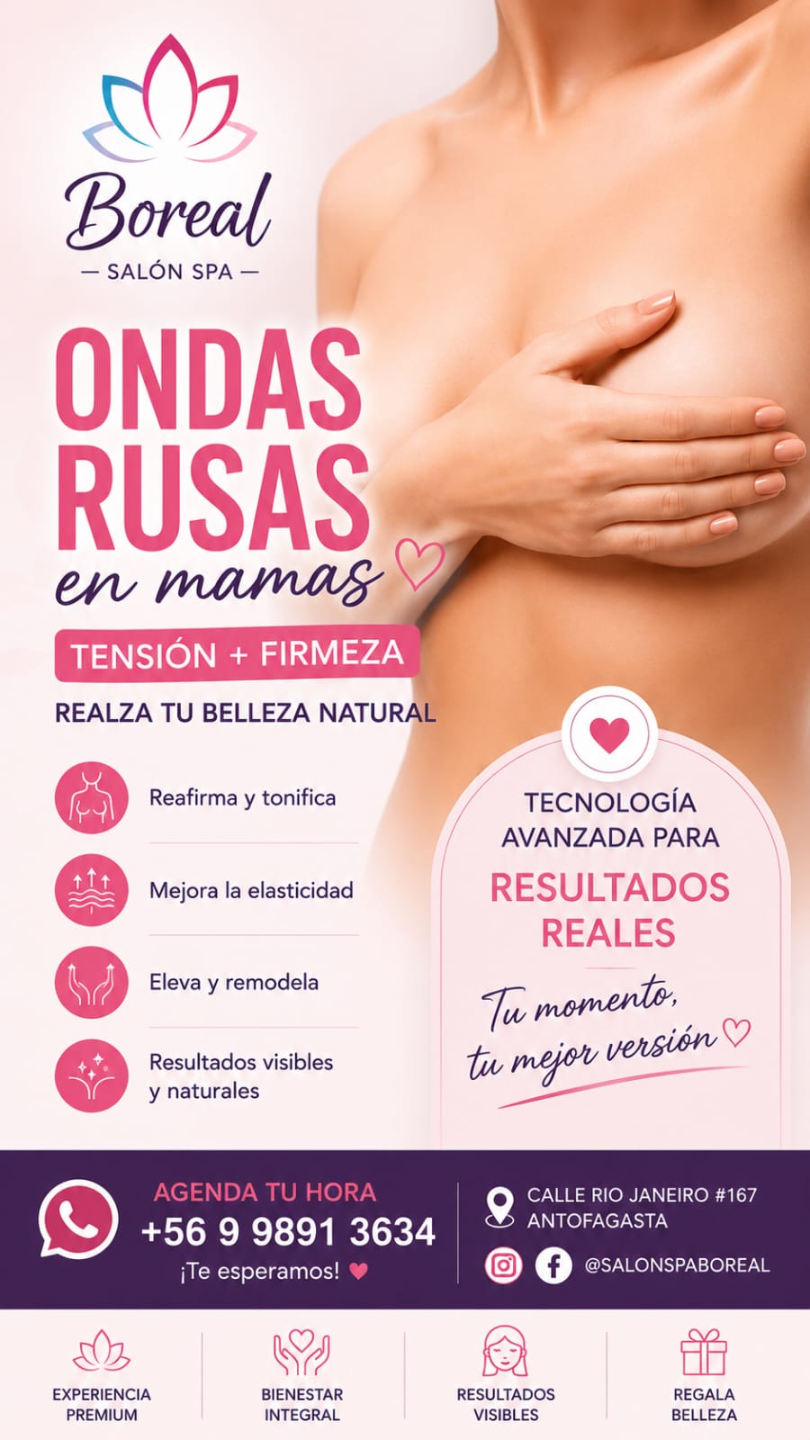 Ondas Rusas en Mamas