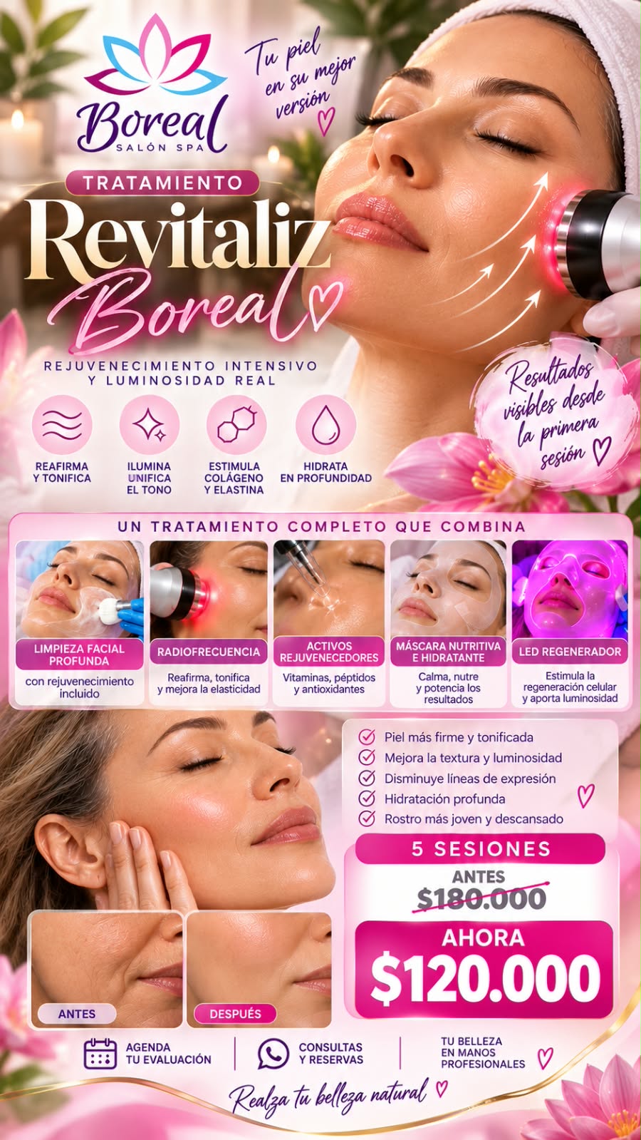 Revitaliz Boreal Promocion Tratamientos Estéticos